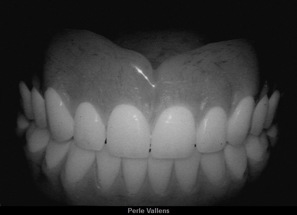 dentier ©Perle Vallens